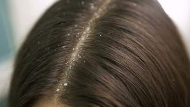 Kepek Tedavisi İçin Kullanılan Saç Bakım Ürünleri